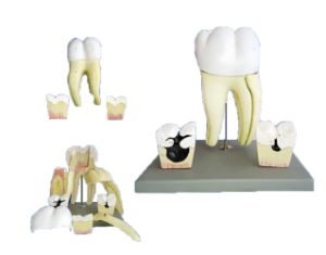 مولاژ مدل دندان (ساختمان دندان آسیا)